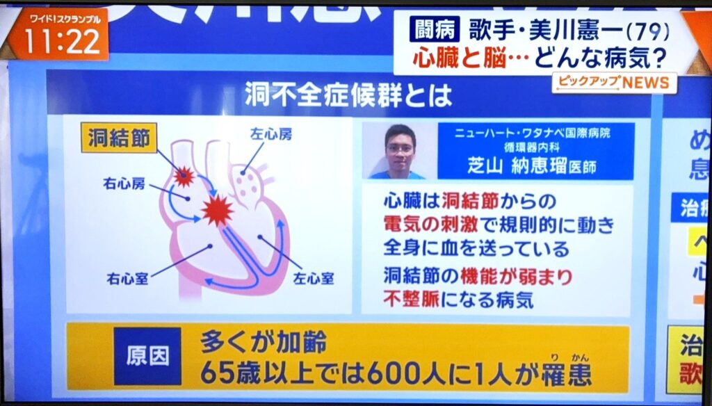 11/14（金）テレビ朝日「ワイドスクランブル」に芝山医師が出演いたしました