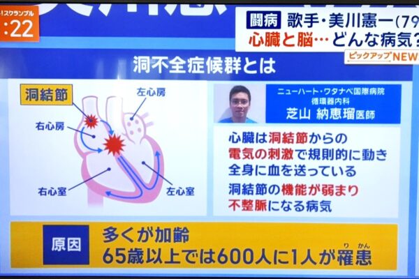 11/14（金）テレビ朝日「ワイドスクランブル」に芝山医師が出演いたしました